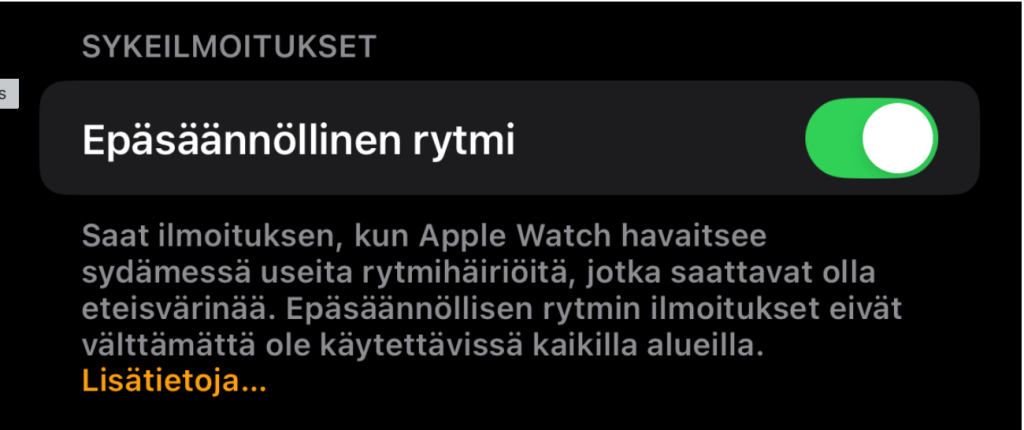 Epäsäännöllisen rytmin asetusikkuna